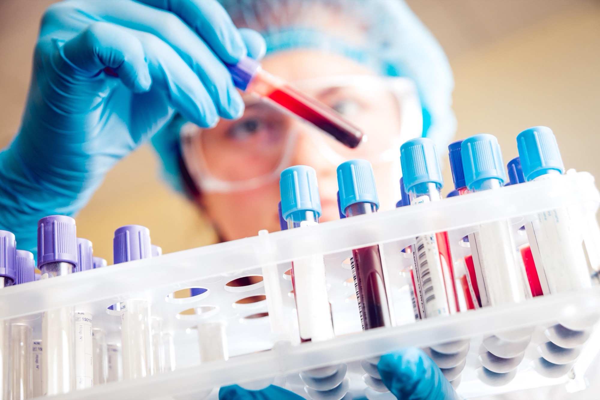 Laboratóriumi szakember vérmintát vizsgál kémcsövek között